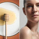 Bất ngờ với 6 cách trị nám tàn nhang bằng mật ong giúp da trắng mịn