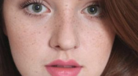 Trị tàn nhang bằng Laser bao nhiêu tiền?