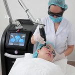 Điều trị tàn nhang mang lại hiệu quả đáng ngạc nhiên với Laser Picosure