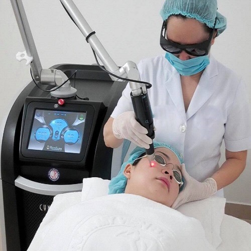 Điều trị tàn nhang mang lại hiệu quả đáng ngạc nhiên với Laser Picosure