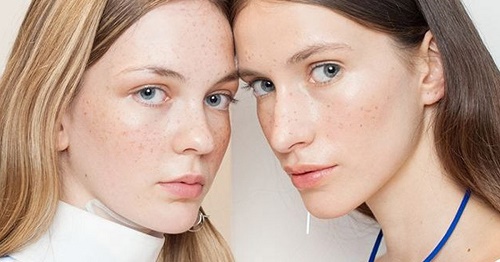 nguyên nhân bị tàn nhang