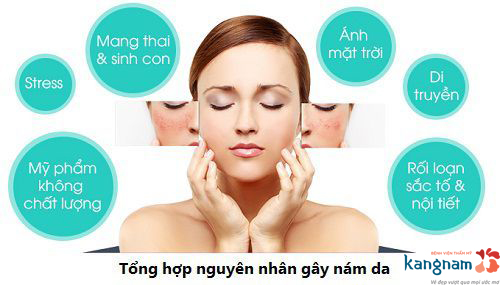 nguyên nhân nám da