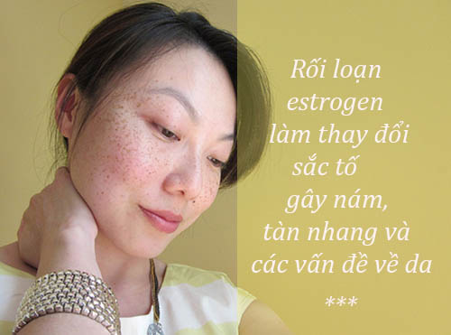 nguyên nhân dẫn đến tàn nhang