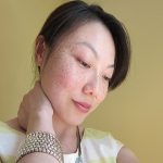 Nguyên nhân gây tàn nhang có đơn giản như bạn nghĩ không?