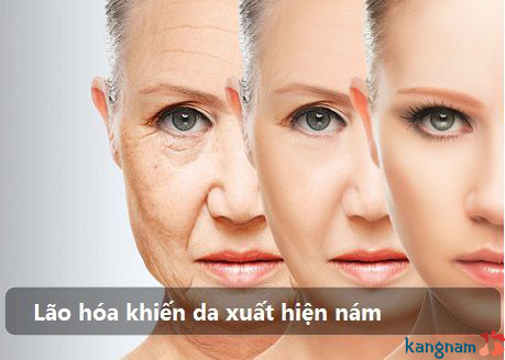 nguyên nhân nám da mặt