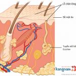 Nguyên nhân gây mụn thịt là gì? Chia sẻ các cách chữa mụn thịt quanh mắt hiệu quả