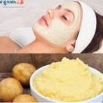 Bật mí 7 cách trị nám tàn nhang sau sinh cực hiệu quả cho các mẹ mới sinh