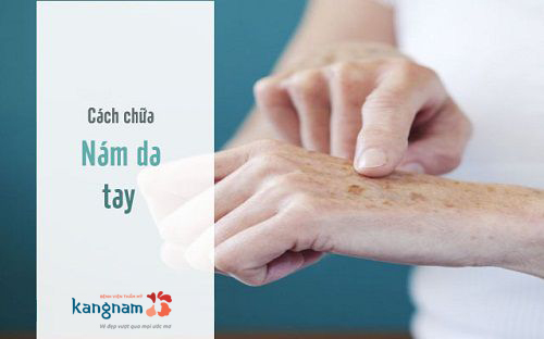 Chia sẻ cách trị nám da tay hiệu quả của bà mẹ U40