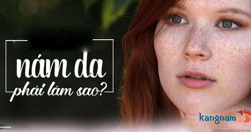 Học thuộc lòng ngay cách chăm sóc, phòng ngừa nám da mặt hiệu quả