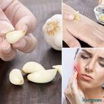 5 cách điều trị mụn thịt bằng tỏi phổ biến hiệu quả và những lưu ý cần biết