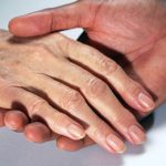 Xuất hiện đốm nâu trên da tay là hiện tượng gì? Điều trị như thế nào?