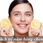 3 Sự thật khoa học về phương pháp trị nám bằng chanh