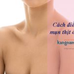 Mụn thịt ở ngực có khó chữa không? Đi tìm giải pháp trị mụn thịt ở ngực hiệu quả!