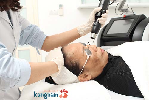 mặt nạ hành tây trị tàn nhang