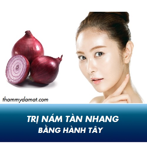 trị nám bằng hành tây 