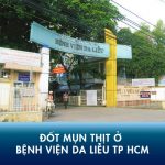 Các thông tin cần phải nắm rõ khi đốt mụn thịt tại bệnh viện da liễu TPHCM