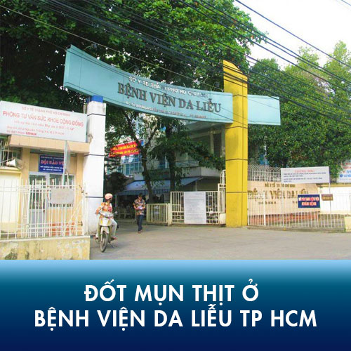 Các thông tin cần phải nắm rõ khi đốt mụn thịt tại bệnh viện da liễu TPHCM