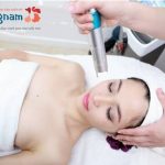 Laser Toning - Công nghệ ĐỘT PHÁ đánh bay nám, tàn nhang cho da sáng mịn