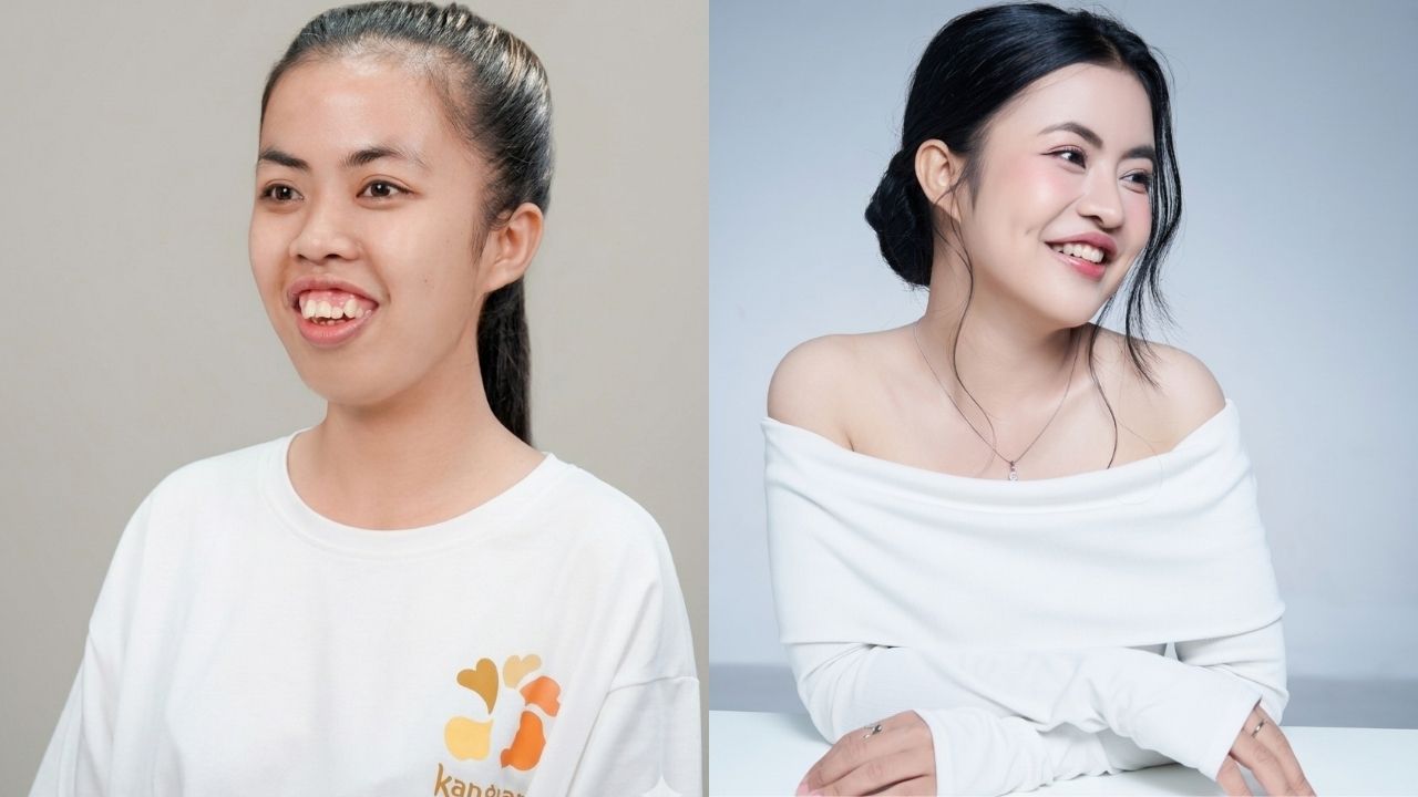 Kangnam tài trợ phẫu thuật miễn phí cho thí sinh Hành trình Lột xác có đúng không?