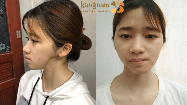 Những trường hợp gặp khuyết điểm trên cơ thể, có tài năng và khát vọng vươn lên